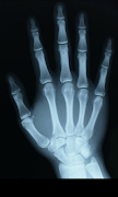 Prank X-Ray Scanner screenshot 3