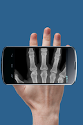Xray Scan Prank capture d'écran 4