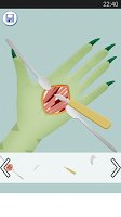 Monster Hand Surgery ภาพหน้าจอ 2