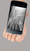 X-Ray Scanner Prank imagem de tela 4