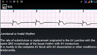 Ecg Interpretation syot layar 3