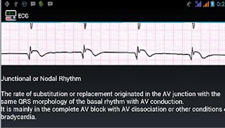 Ecg Interpretation screenshot 3