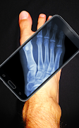 برنامه‌نما XRay Body Scanner Simulator عکس از صفحه