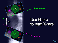 Goniometer Pro Trial Version Ekran Görüntüsü 4