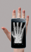 X-Ray Scanner Prank スクリーンショット 1