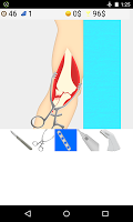 elbow surgery games poster