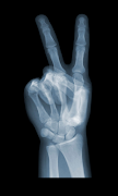 Prank X-Ray Scanner screenshot 4