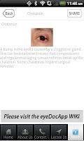 EYESEE screenshot 2