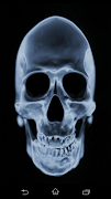 7 Schermata Xray Scan Prank