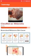 DermoApp: Skincancer detection ภาพหน้าจอ 1
