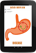 1 Schermata Acid Reflux