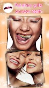 Braces Teeth Photo Editor screenshot 1