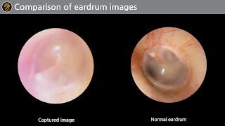 RefitCam Medi 截圖 4