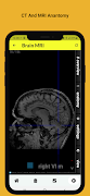 Radiology Anatomy CT And MRI скриншот 3