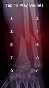برنامه‌نما Bone Breaking Cracking Sounds عکس از صفحه