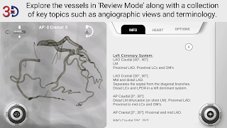 AngioAID 3D screenshot 3