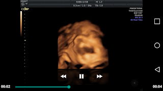Prebebé screenshot 3