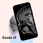 CT Brain اسکرین شاٹ 2