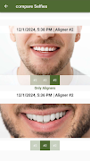 Only Aligners स्क्रीनशॉट 5