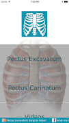 Pectus Clinic পোস্টার
