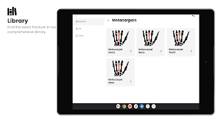 Fractures capture d'écran 5