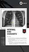Chest X-Ray Interpretation screenshot 3