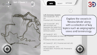 برنامه‌نما AngioAID 3D عکس از صفحه