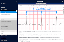5 Schermata ECG APPtitude