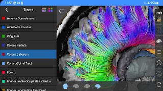 Brain Tutor 3D screenshot 6