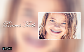 Braces Teeth Camera ภาพหน้าจอ 5