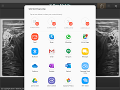 X-Ray Mobile 截图 6
