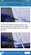Suture Guidelines screenshot 1