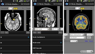 3-D brain Atlas poster