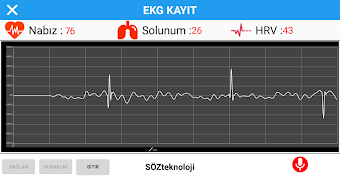Mini EKG captura de pantalla 5
