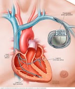 CardioPic screenshot 5