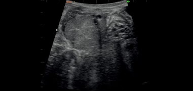 IbexStream screenshot 1