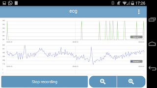 Bitadroid Screenshot 2