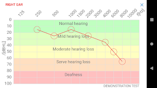 Hearing Test スクリーンショット 5