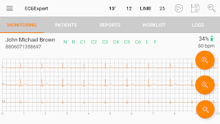 2 Schermata ECG Expert