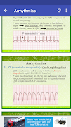 3 Schermata A to Z ECG Interpretation