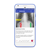 X-Ray Interpretation Guide स्क्रीनशॉट 7