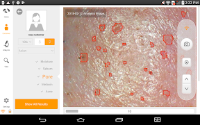 Skinview screenshot 4