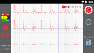 INcardio screenshot 7