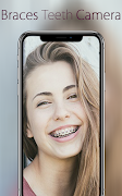 Braces Teeth Camera скриншот 4