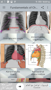 2 Schermata Chest X-Ray Interpretation