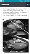 CardioMRI screenshot 5