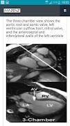 5 Schermata CardioMRI