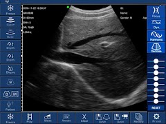 WirelessUSG screenshot 2