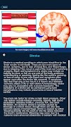 7 Schermata Brain Anatomy Pro.