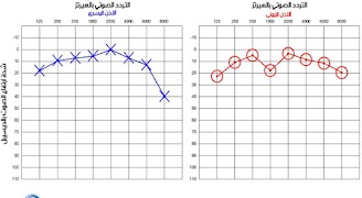 مخطط السمع 스크린샷 3